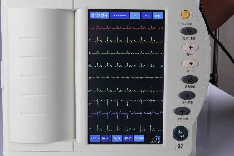 Macchina ECG umana esame cardiaco cardiologia elettrocardiografo a 12 canali elettrocardiogramma ECG