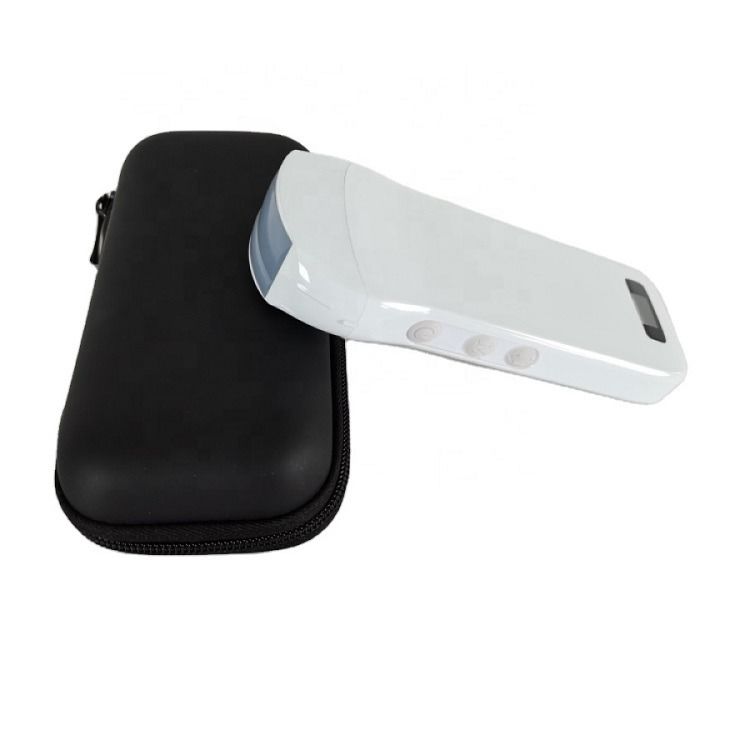 Usg Nuovo Aspetto Immagine 3D GYN Immagine Laptop Ob Gyn Ecografo Fetal Doppler a Colore con Alta Qualità
