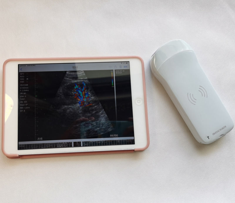Usg Nuovo Aspetto Immagine 3D GYN Immagine Laptop Ob Gyn Ecografo Fetal Doppler a Colore con Alta Qualità