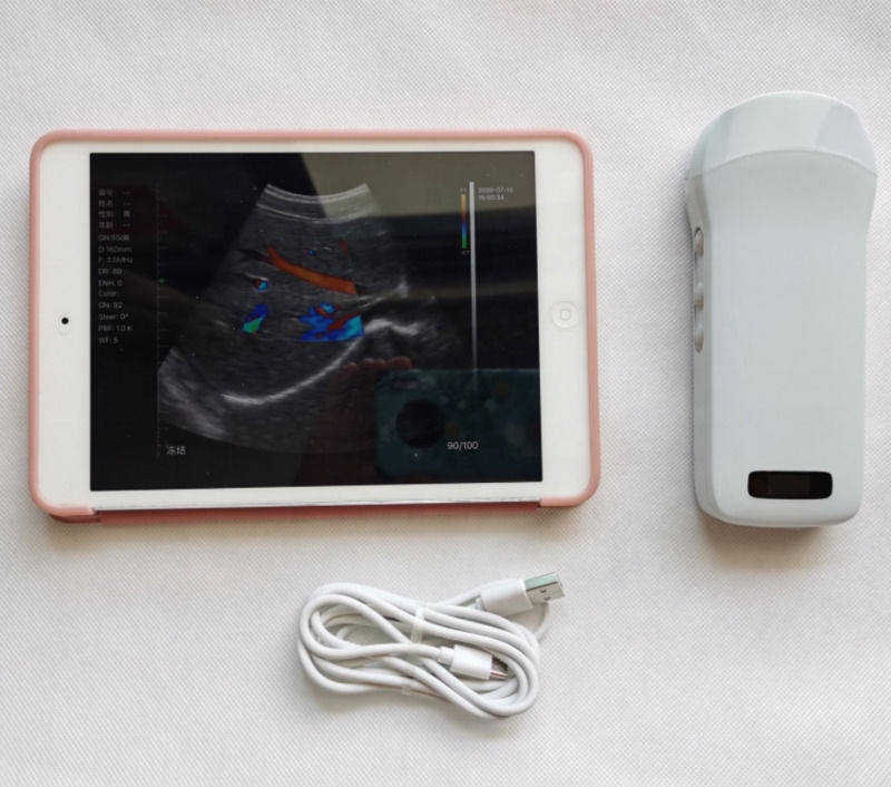 Usg Nuovo Aspetto Immagine 3D GYN Immagine Laptop Ob Gyn Ecografo Fetal Doppler a Colore con Alta Qualità