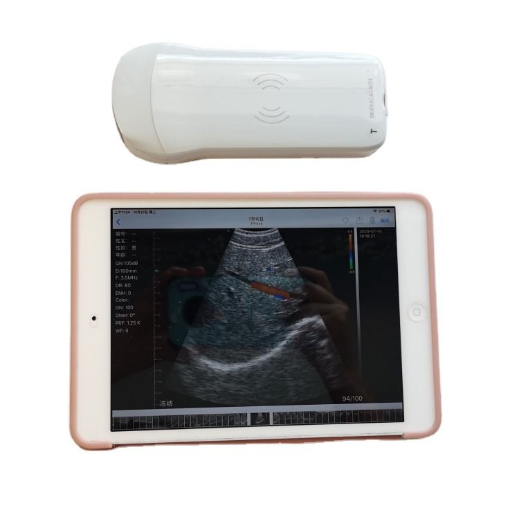 Ecografo Veterinario Portatile di Alta Qualità GYN, Consegna Veloce, Diagnostica 3D per Cavalli, Macchina ad Ultrasuoni Medica per Bovini