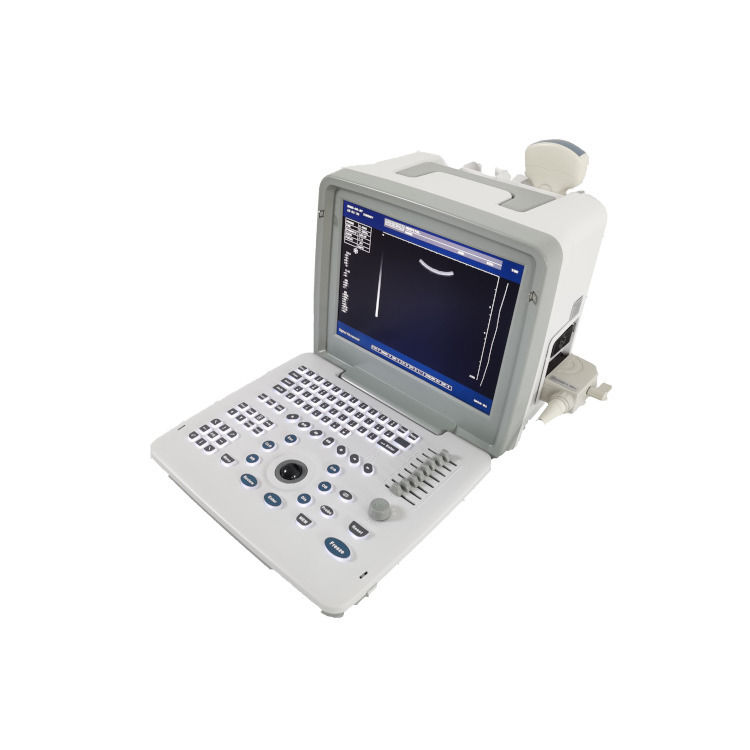 Metal See Laptop B W Portatile Gravidanza Doppler Probe Scanner Radio Fetal Ultrasound Machine per il bambino