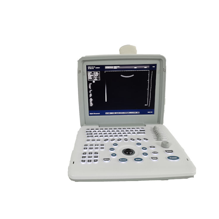 Metal See Laptop B W Portatile Gravidanza Doppler Probe Scanner Radio Fetal Ultrasound Machine per il bambino
