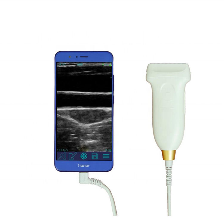 Sonda ecografica ginecologica convessa wifi usb sonde ecografiche wireless per Android