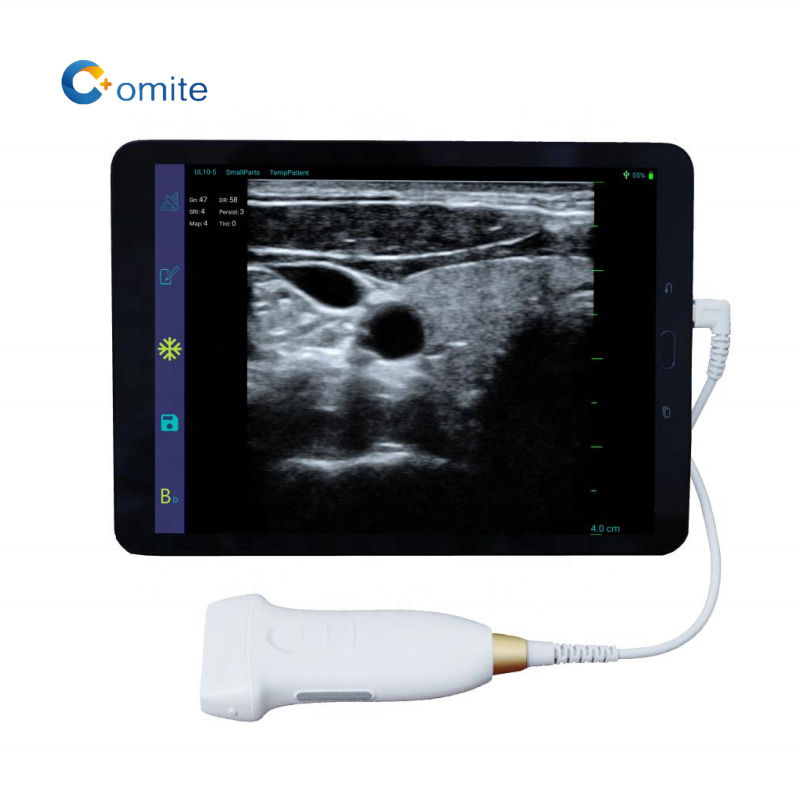 Sonda ecografica ginecologica convessa wifi usb sonde ecografiche wireless per Android
