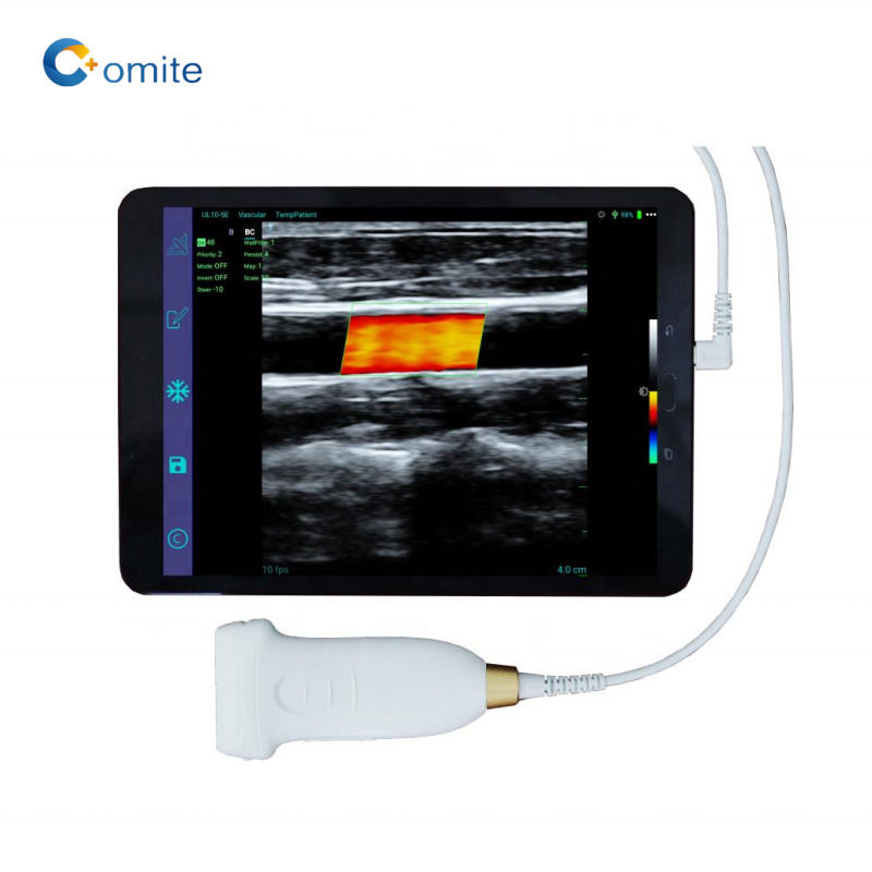 GYN Ultrasound Probe 3 in 1 usb wifi convesso ultrasuoni sonde wireless per android