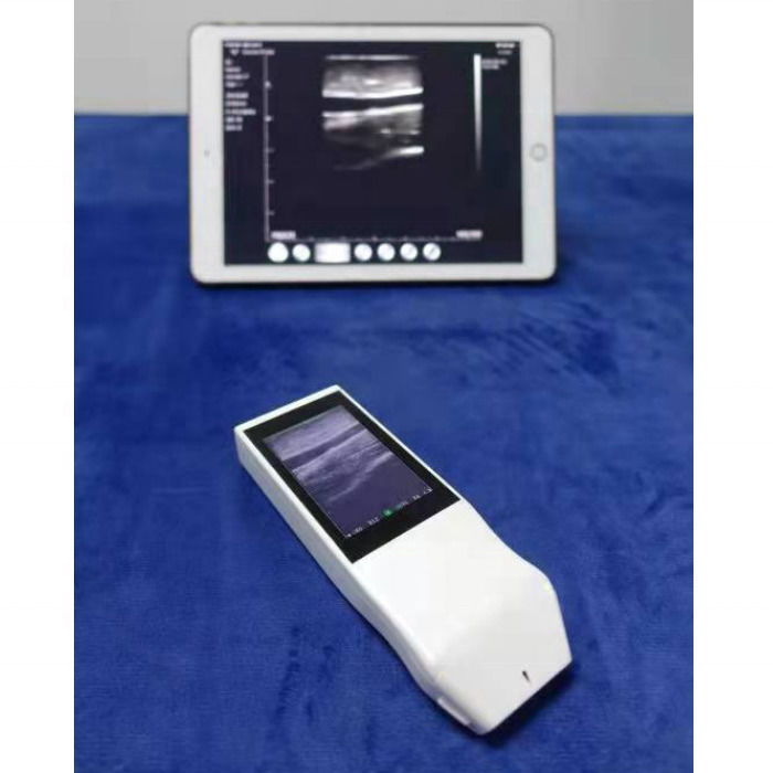 WIFI Wireless Color Probe GYN Ultrasuoni Probe lineare con display Anestesia Punzione Navigazione Ultrasuoni portatili