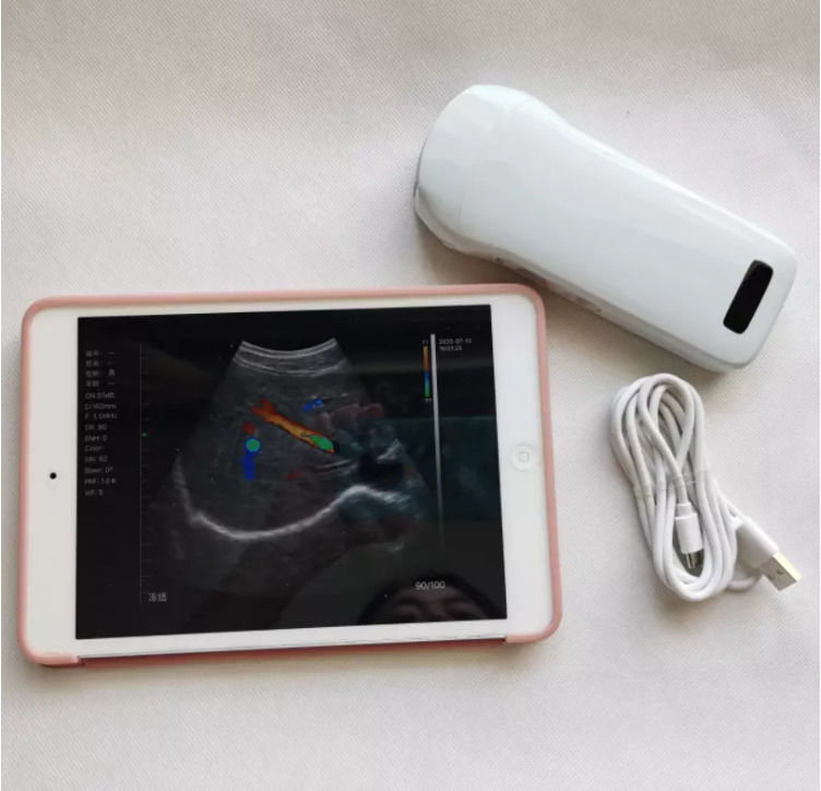 Strumenti a ultrasuoni ginecologici Sonda clinica portatile senza fili Strumenti analitici Ecografo portatile mobile