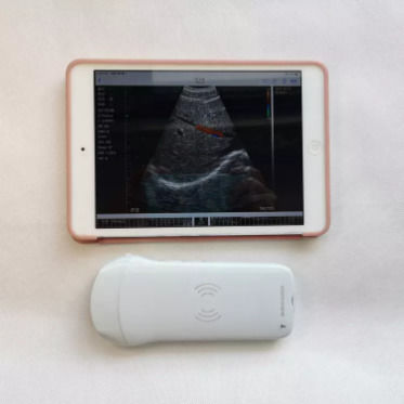 Strumenti a ultrasuoni ginecologici Sonda clinica portatile senza fili Strumenti analitici Ecografo portatile mobile