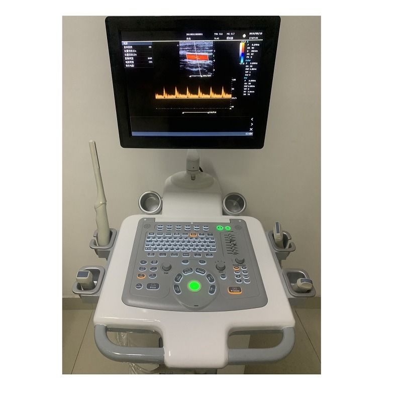 Ospedale Fuori Trolley 15 Inch Ultrasound Machine Ultrasound Digital Color Doppler Ultrasound Machines edical