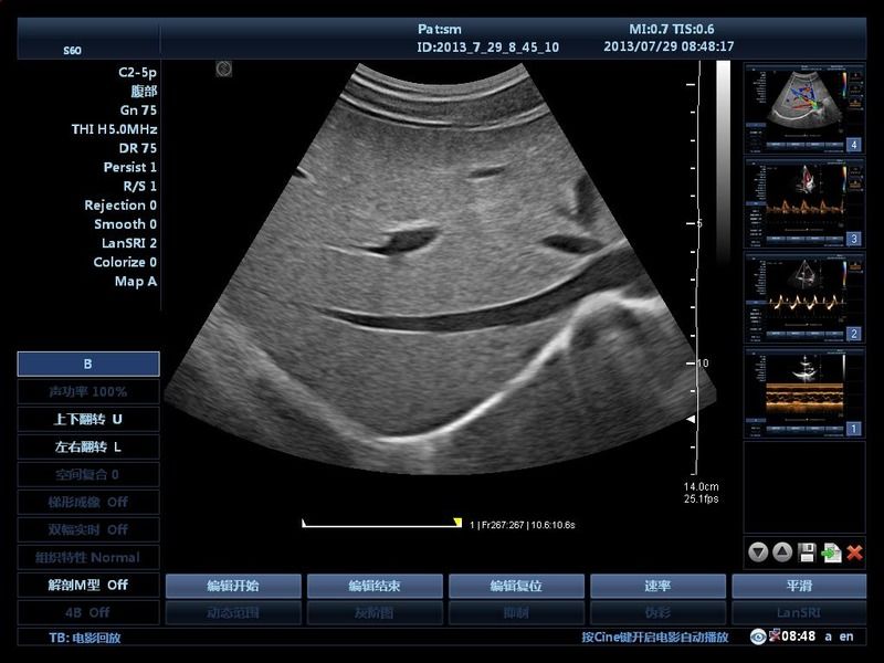 Ospedale Fuori Trolley 15 Inch Ultrasound Machine Ultrasound Digital Color Doppler Ultrasound Machines edical
