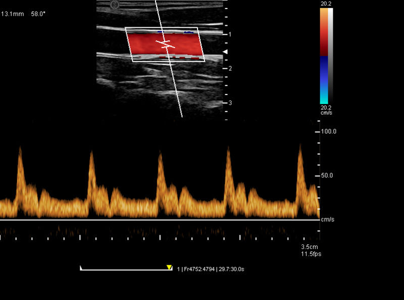 Cina Cart Digital Color Doppler Ultrasound Medical Ultrasound Machine Ultrasound Ospedale esterno