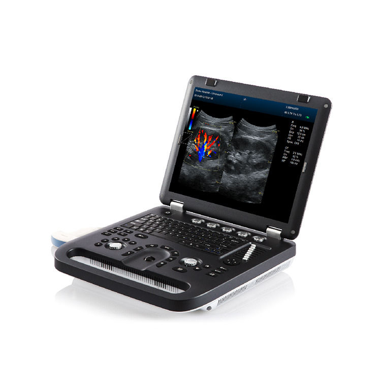 Ecografo a colori Doppler portatile con garanzia del 100%