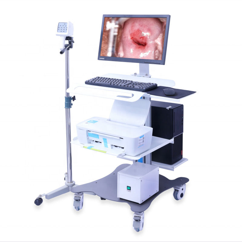 Colposcopio Ginecologico Portatile Sistema di Imaging Colposcopio Digitale Esame Vaginale Video Colposcopio per Ginecologia
