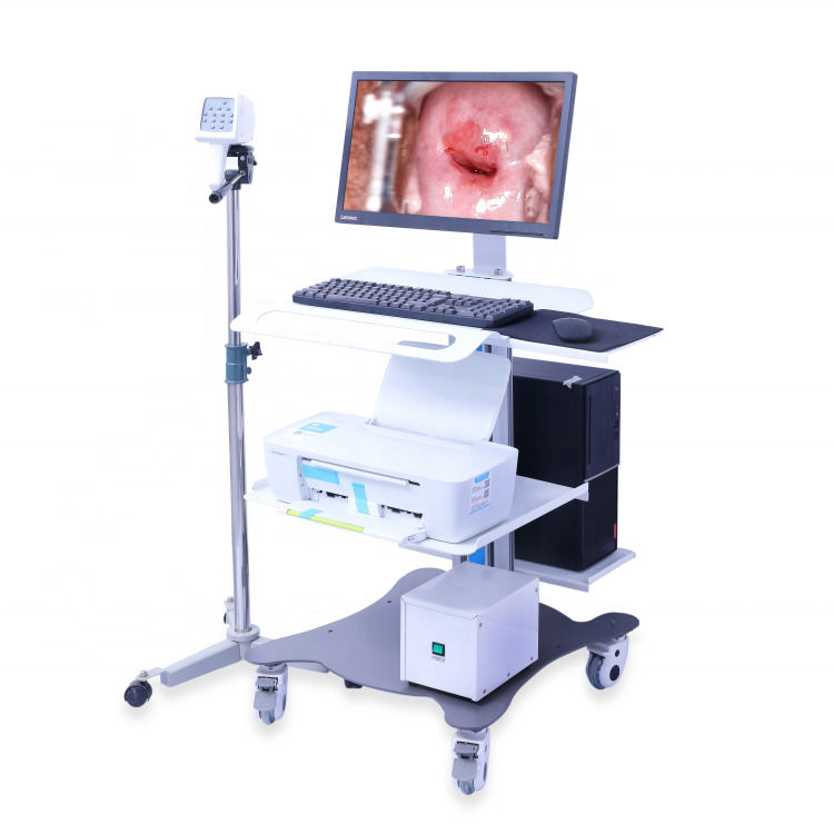 Colposcopio Ginecologico Portatile Sistema di Imaging Colposcopio Digitale Esame Vaginale Video Colposcopio per Ginecologia