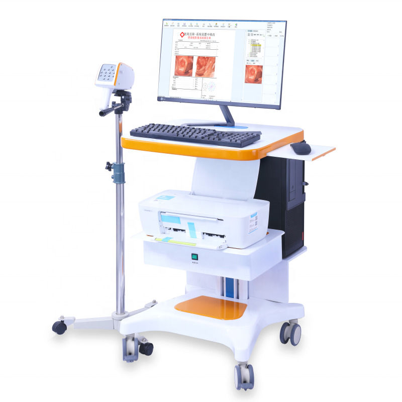 Colposcopio Ginecologico Portatile Sistema di Imaging Colposcopio Digitale Esame Vaginale Video Colposcopio per Ginecologia